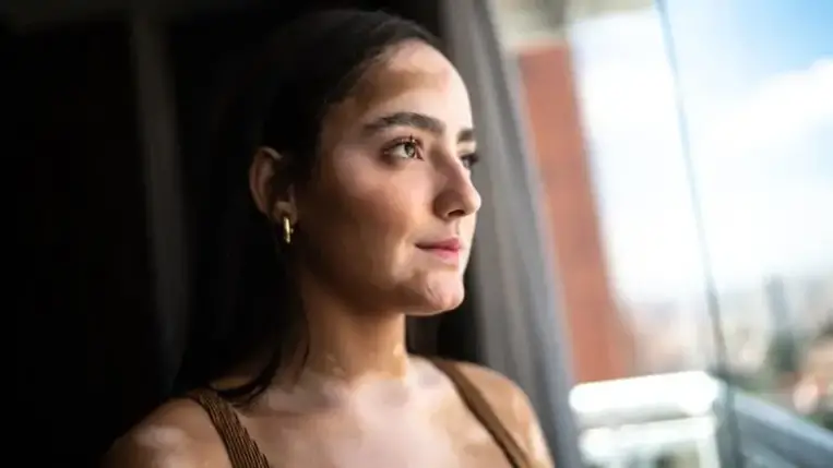 Rejtélyes fehér foltok a bőrön: mi okozza?