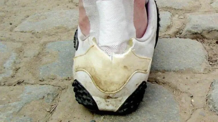 Leggyakoribb hibák a cukorbetegség kezelésében