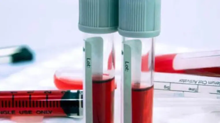 Amikor túl sok a vas- hemokromatózis