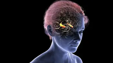 Kiderült, miért érinti gyakrabban a nőket az Alzheimer-kór