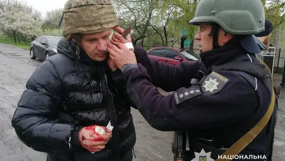 Gránátrobbanás Dnyipropetrovszk megyében – öt rendőr megsérült. Fotó: Ukrán Nemzeti Rendőrség