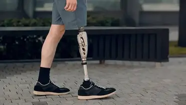 Az ukrajnai háborúban megsérült betegek kapnak művégtagot Budapesten egy humanitárius program keretében. Illusztráció