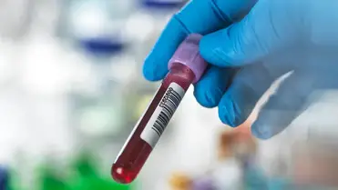 A B-vércsoport és a diabétesz kapcsolata: ezt találták a kutatók