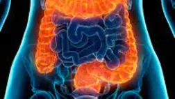 Őssejtterápiával is gyógyítják a Crohn-betegség egyik változatát