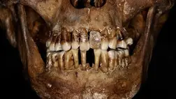 Ijesztő titka volt a 17. századi arisztokratának a fogai megőrzésére