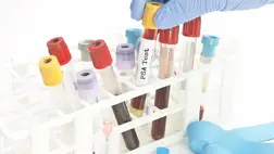 Több mint 50 ráktípust kimutató vérvizsgálatot teszteltek biztató eredményekkel