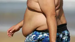 Elhízás. Illusztráció. Fotó: Internet