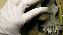 A vikingek fogromlástól szenvedtek 