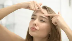 Ezt kend a pattanásra, hogy reggelre eltűnjön - Házi megoldások, de gyorsan hatnak