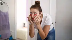 Rövid idő alatt megszüntethetőek a szem alatti karikák és táskák