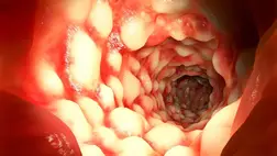 Borzasztó felfedezés: megtalálták az első vámpírbaktériumokat, embervért esznek 