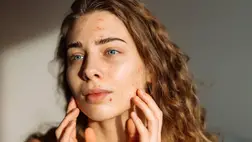 5 mindennapi szokás, ami gyulladásokat okoz a bőrön