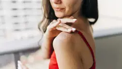 5 természetes SOS megoldás napégésre 