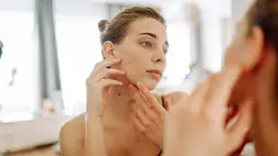 9 bőrtünet, amiről nem gondolnád, hogy emésztési probléma okozza