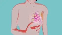 Egyetlen adag gyógyszer eltüntetheti a daganatot 