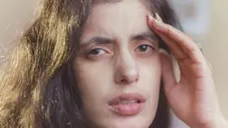 Ezek a B12-vitamin-hiány jelei a bőrön