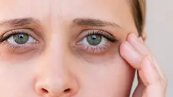 Karikás szemek, ráncos, száraz bőr – Meglepő dologra figyelmeztetnek a tünetek