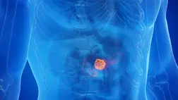 Mutatunk egy módszert, amivel kivédhető a leghalálosabb rákbetegség