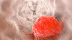 Rájöttek, miért okozhat a tea rákot 