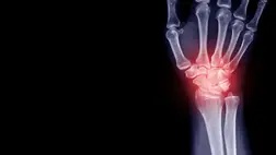 Rémisztő dolgot találtak az emberi csontban; mindannyiunkban ott lehet