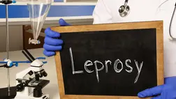 Leprás megbetegedést igazoltak Kolozsváron egy ázsiai nőnél. Illusztráció. Fotó: Shutterstock