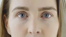 Az egyik legfontosabb ásványi anyag hiányzik, ha ilyen az arcod