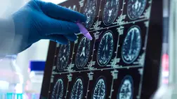 Megvan a rettegett betegség ellenszere? Ígéretes anyagot találtak a népszerű növényben