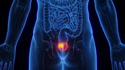 Sokkoló adat: tömegesen diagnosztizálják félre a nőket ezzel a betegséggel