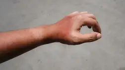 A bőrrák rejtett oka, amire sokan nem is gondolnak