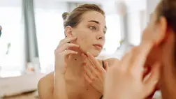 9 bőrtünet, amiről nem gondolnád, hogy emésztési probléma okozza