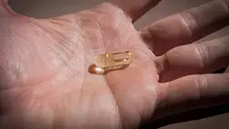 D-vitamin-hiány: újabb súlyos betegséggel hozták összefüggésbe