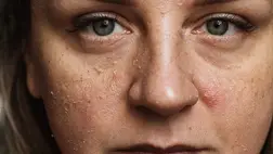 10 évet öregít rajtad ez a rossz szokás