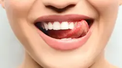 Ezek az ételek és italok károsítják a fogzománcot