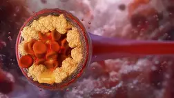 Felfedezték a koleszterin csökkentésének egy forradalmi új módszerét