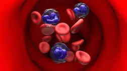 Ez lehet a leukémia legelső jele, amit eddig senki sem vett észre