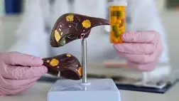 Zsírmáj és májzsírosodás: egy ismert vitamin bizonyult a leghatásosabbnak
