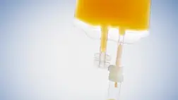 Szenzációs felfedezés: megvan a vitamin, ami gyilkolja a rákos sejteket