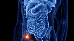 Kiadták a figyelmeztetést: megugrott egy ritka rákfajta előfordulása a fiatalok körében