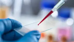 Senki sem hitte, hogy ez lehetséges: döbbenetes dolgot találtak a vérben