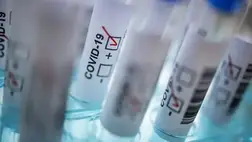 Jön a Szputnyik V orrcsepp