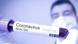  Az ukrán Egészségügyi Minisztérium újabb covid-antirekordokra számít 