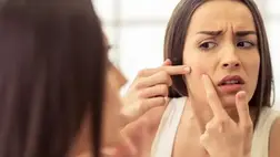 Meglepő dolgok, amik pattanásokat okoznak