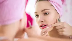 A pattanások kialakulásának legfőbb okai