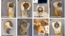 Drágaköveket ragasztottak a fogaikba az ősi maják