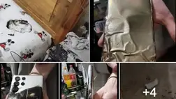 Felrobbant az okostelefonja, súlyosan megsérült