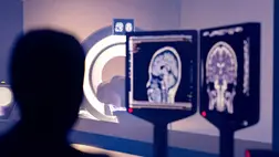 Az agyvelőgyulladást és tüdőgyulladást okozó vírusok növelik az olyan neurodegeneratív betegségek kockázatát, mint a Parkinson-kór és az Alzheimer-kórForrás: Science Photo Library via AFP/SAMUNELLA/SCIENCE PHOTO LIBRARY/Samunella/Science Photo Library