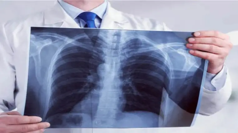 Elhúzódó köhögés tüdőgyulladás után