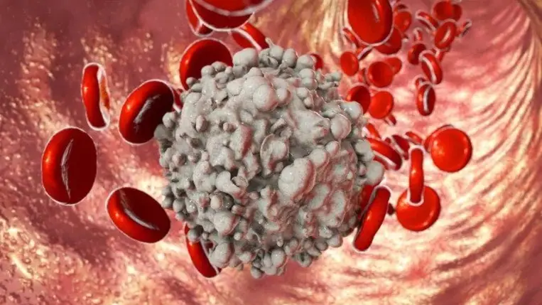 Máj véna trombózis- mit kell tudni róla?