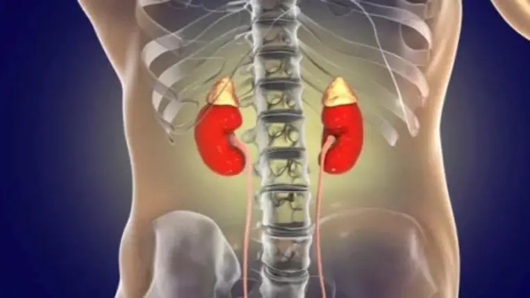 Szívdobogást, mellkasi fájdalmat is okozhat a Conn-szindróma