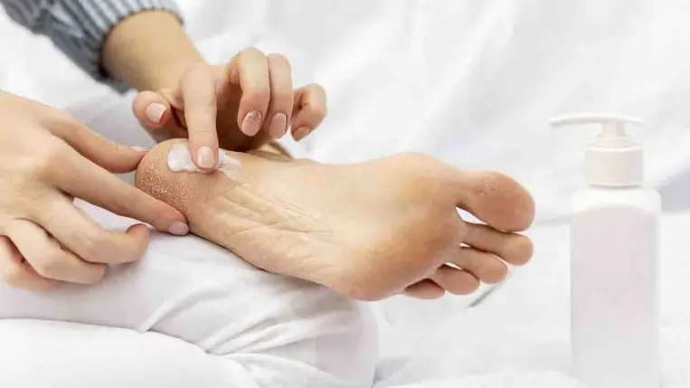 A pajzsmirigyzavar 4 meglepő tünete a lábakon: sokan nem veszik komolyan a jeleit